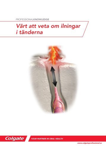 Värt att veta om ilningar i tänderna - Colgate Professional