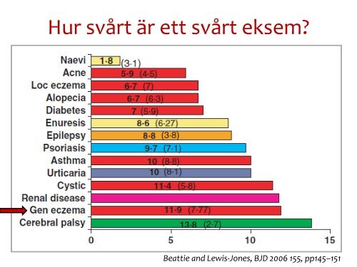 Svåra eksem, Natalia Ballardini - Barnallergisektionen