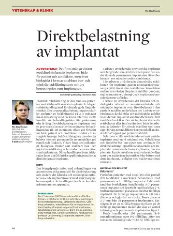 Direktbelastning av implantat - Tandläkartidningen