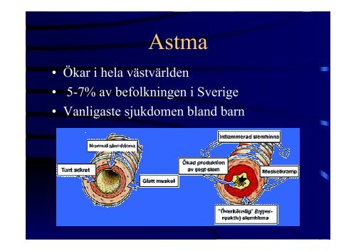 Kroniska sjukdomar hos barn- odontologiska konsekvenser