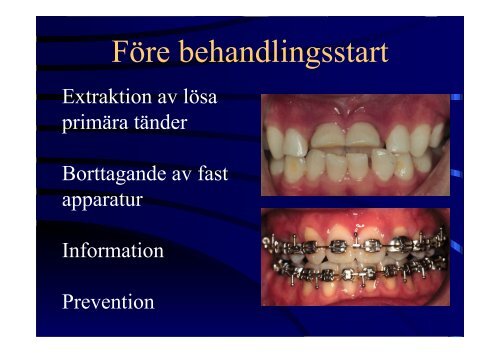 Kroniska sjukdomar hos barn- odontologiska konsekvenser