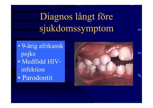 Kroniska sjukdomar hos barn- odontologiska konsekvenser
