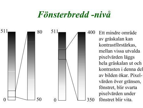 DATORTOMOGRAFI