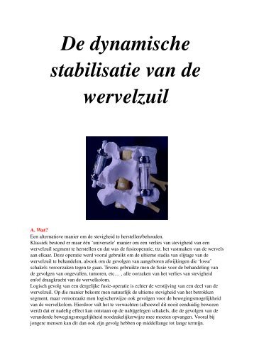 De dynamische stabilisatie van de wervelzuil