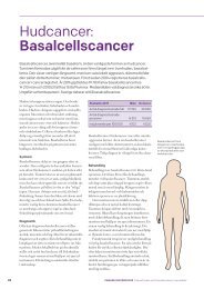 Hudcancer: Basalcellscancer - Cancerfonden