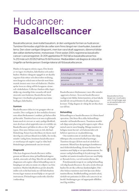 Hudcancer: Basalcellscancer - Cancerfonden