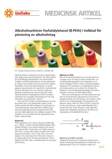 Alkoholmarkören fosfatidyletanol - Unilabs