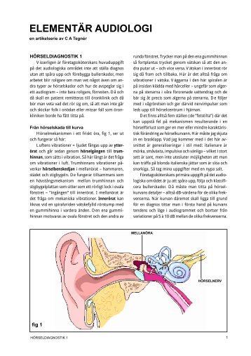 Hörseldiagnostik 1 - categner.se