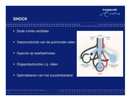 Lichaam, houding, beweging en rust: - Topics in Intensive Care