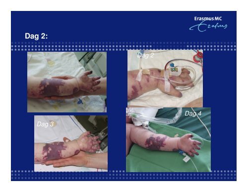 Lichaam, houding, beweging en rust: - Topics in Intensive Care