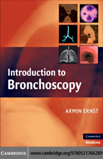 Introduction to Bronchoscopy - Airlangga Ebooks Collections