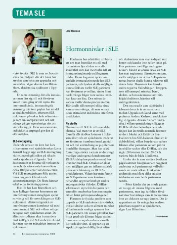 Hormonnivåer vid SLE