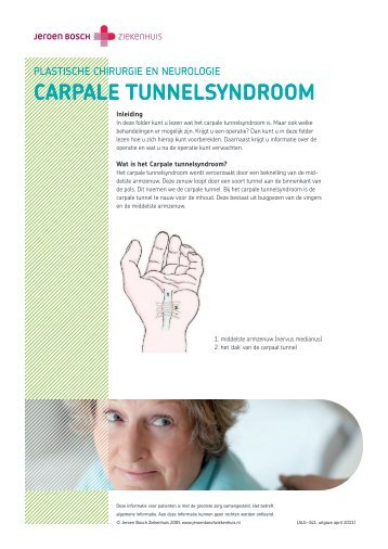 Carpale tunnelsyndroom - Jeroen Bosch Ziekenhuis