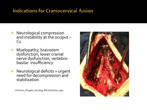 Recognition of Cranio-Cervical Instability in the Complex Chiari ...