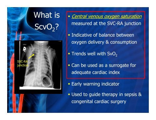 Value of ScvO2 Monitoring in PICU - The Canadian Association of ...