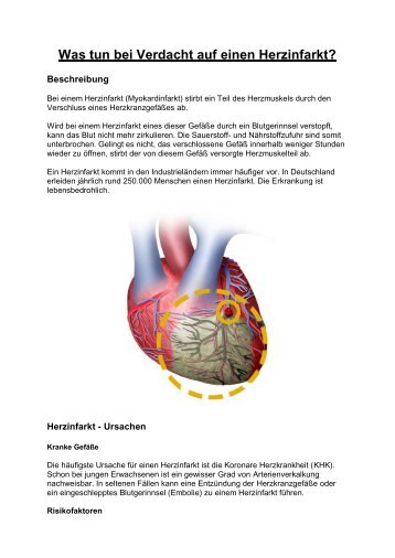 Was tun bei Verdacht auf einen Herzinfarkt? - OFw Buchholz