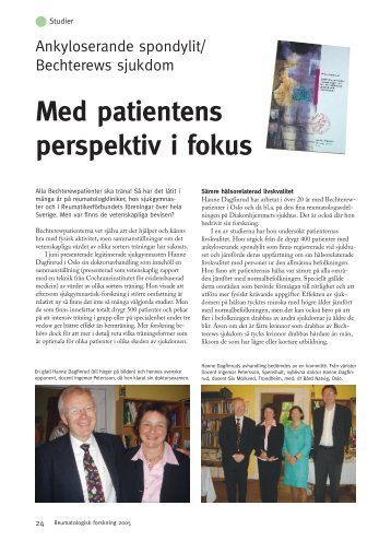 24 Ankyloserande spondylit/Bechterews sjukdom, Med patienten i ...