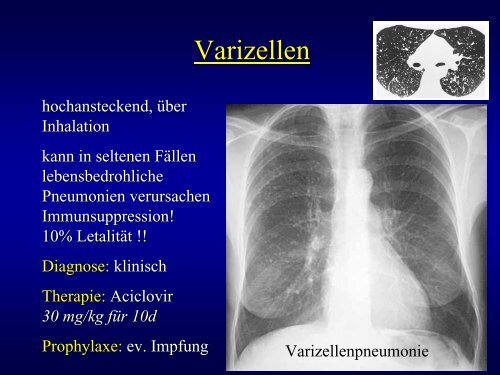 106 Pneumonien (3,3%)  bei 3220 Rekruten mit ... - Die Abteilung