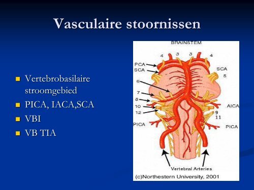 Vertigo en neurologie - hermankingma.com