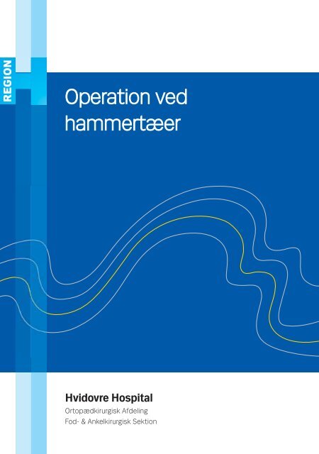 Operation ved hammertæer