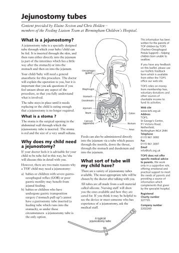 Jejunostomy tubes - Inside Out Stoma Support Group