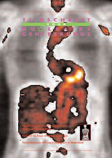 Nummer 2 - Tijdschrift voor Nucleaire Geneeskunde