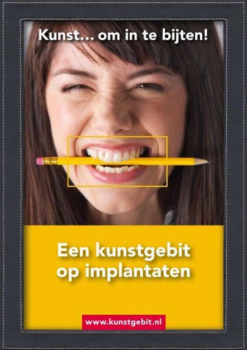 “Een kunstgebit op implantaten” (pdf) - Rutger Weijer