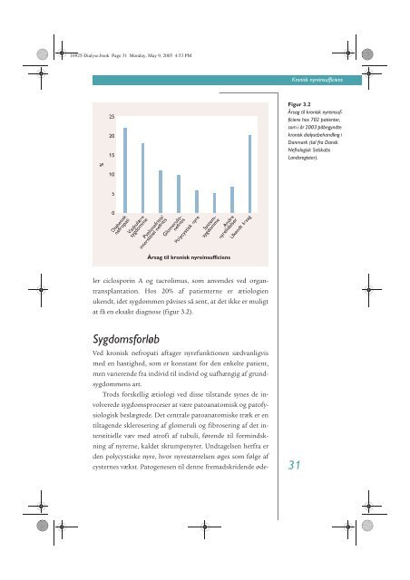 Akut dialyse