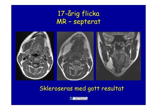 Norrlands Universitetssjukhus Umeå