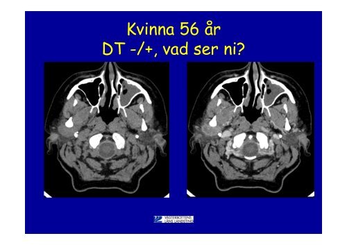 Norrlands Universitetssjukhus Umeå