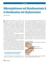 Mikroinjektionen mit Botulinumtoxin A - Laserzentrum Zürichsee