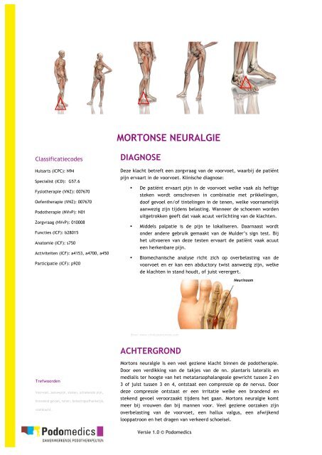 MORTONSE NEURALGIE - Podomedics