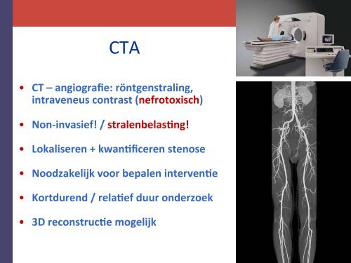 MRA • MRI – angiograf
