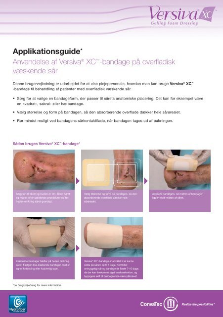 Anvendelse af Versiva ® XC ™ -bandage på ... - ConvaTec