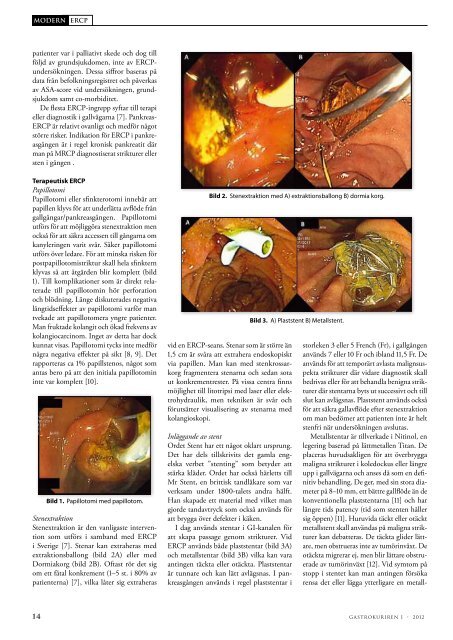 Ladda hem (pdf) - Svensk Gastroenterologisk Förening