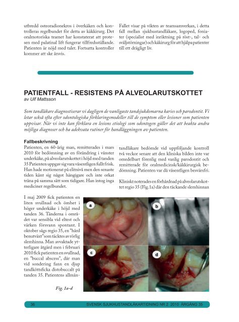 nr 2 2010.pdf - Svensk förening för Orofacial Medicin