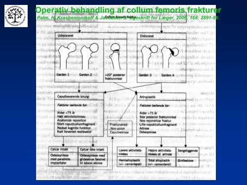 Collum femoris frakturer - a-kursus.dk