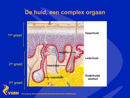 Stamcellen en brandwond genezing - NtVP