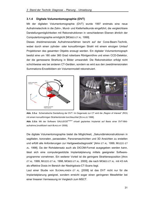 Vergleich zweier Messverfahren zur ... - RWTH Aachen University