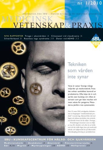 Tekniken som vården inte synar - SBU