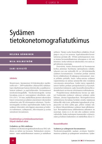 Sydämen tietokonetomografiatutkimus