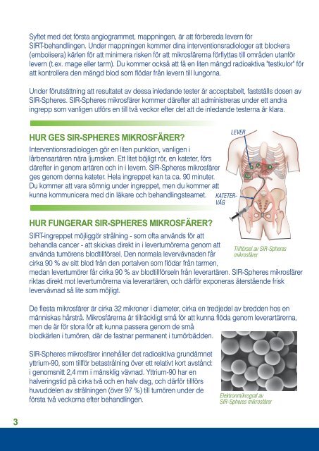 27546 Patient Info.A5 Broch Covers - SIRTeX