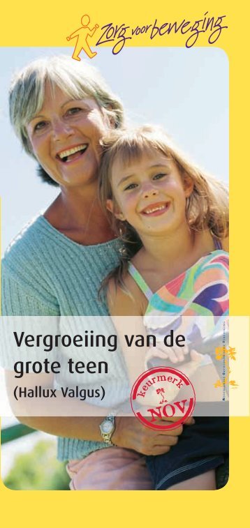 Vergroeiing van de grote teen (hallux valgus)