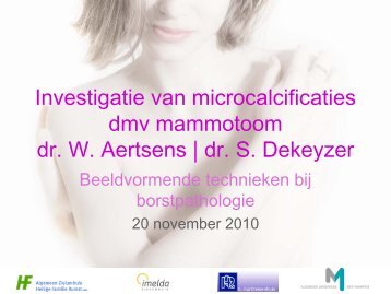 Investigatie van microcalcificatie - AZ Sint-Maarten