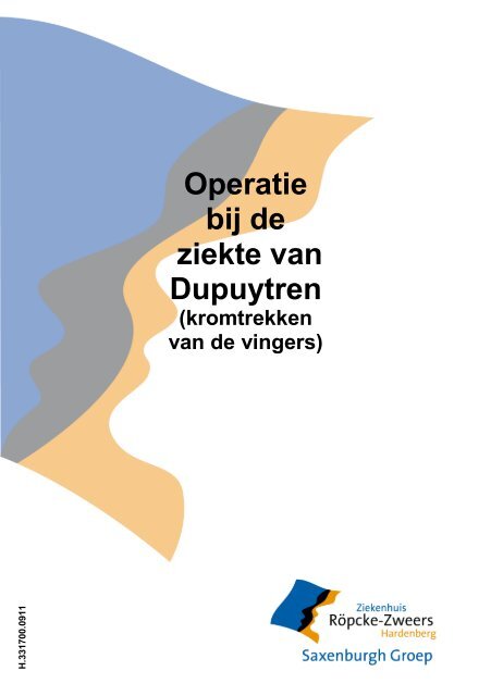 Operatie bij de ziekte van Dupuytren