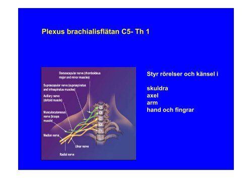 Obstetriska plexus brachialisskador - SFOG