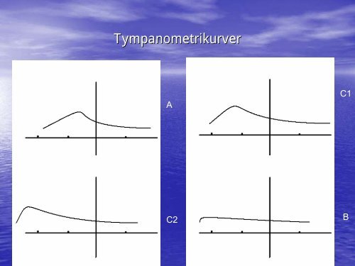 TYMPANOMETRI