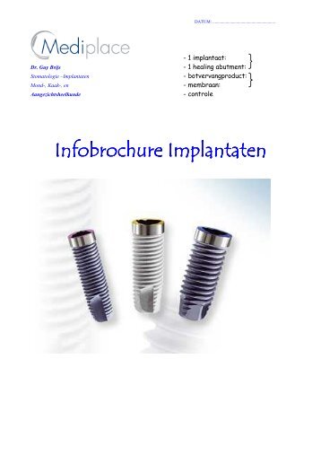 Infobrochure Implantaten Infobrochure Implantaten