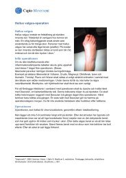 Hallux valgus-operation - Movement