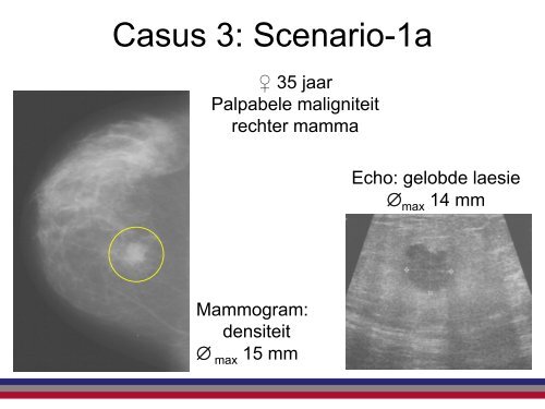 Help, een UBO - NKI / AvL